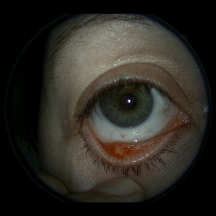 warm eye compress walmart